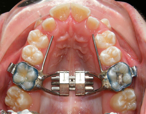 orthodontics