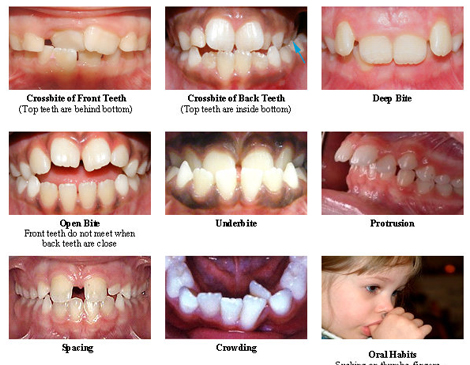 orthodontics